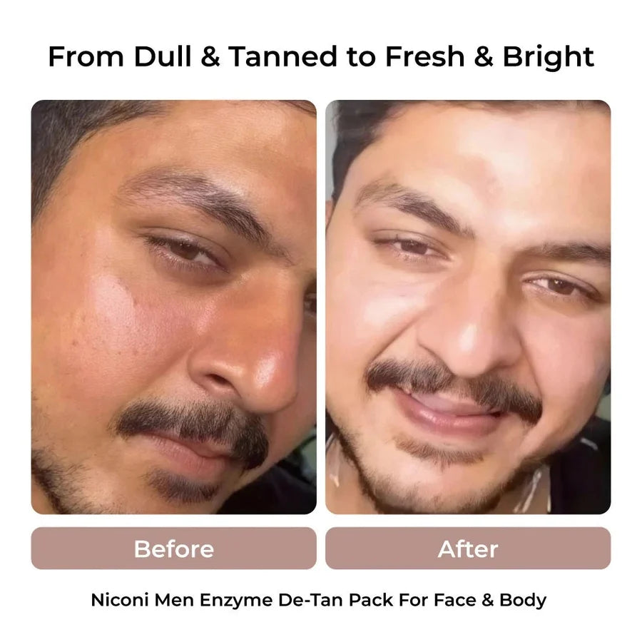 Niconi Men Enzyme De-Tan Pack For Face & Body