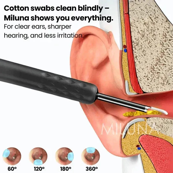 Smart Wireless Ear Cleaner