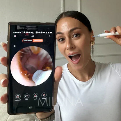 Smart Wireless Ear Cleaner