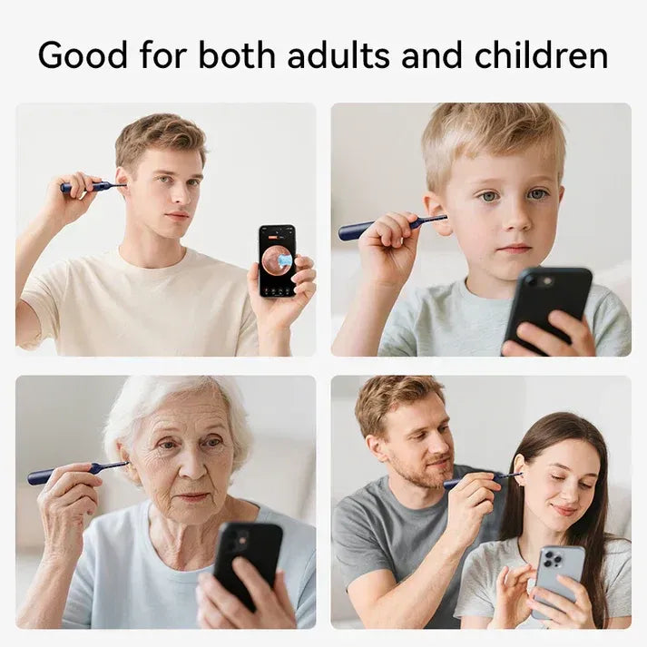 Smart Wireless Ear Cleaner